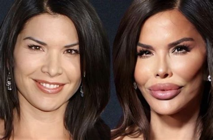 Before and After Plastic Surgery Photos Revealed ·