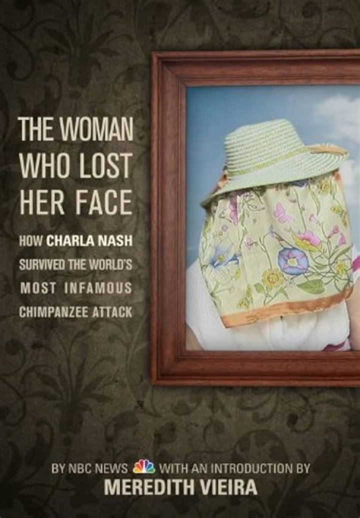 Charla Nash's Face Reveal: Overcoming Adversity With Courage