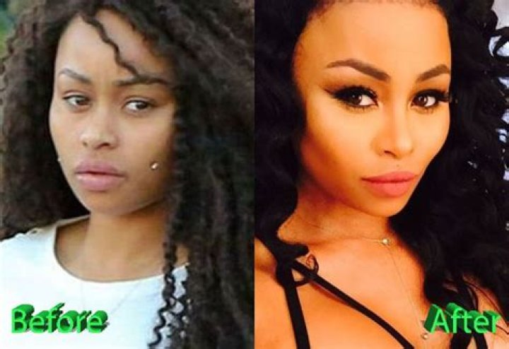 Discoveries Beyond "Black Chyna Before And After"