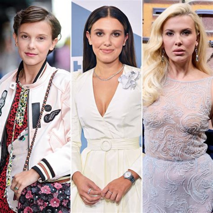 Hailey Bieber's sharp features have always triggered plastic surgery rumors once forcing her to sue