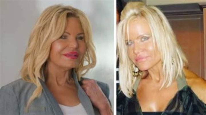 Has Lisa Helou Had Plastic Surgery? Selling the OC Gios Mother Transformation Photos ·