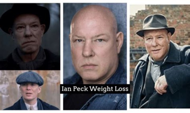 Ian Peck Weight Loss Explained What Happened To The Actor Who Plays Curly In Peaky Blinders? ·