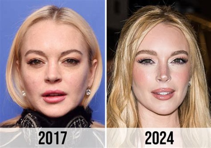 Lindsay Lohan's Face Transformation: Uncovering The Truth
