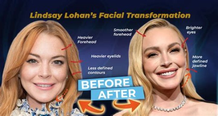 Lindsay Lohan's Plastic Surgery Journey Explored