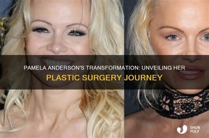 Uncovering Her Plastic Surgery Journey