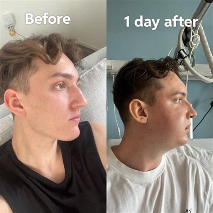 Understanding His Surgery And Recovery