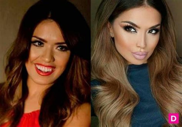 Unveiling The Secrets Of "iluvsarahii Before And After BBL": Your Journey To Transformation